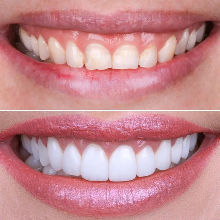 Cosmetic Dentistry